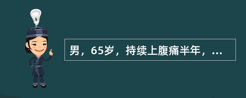 男，65岁，持续上腹痛半年，消瘦乏力，偶有恶心、呕吐，查体贫血貌，上腹剑突下轻压痛。最可能的诊断是