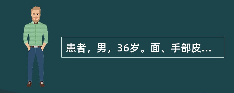 患者，男，36岁。面、手部皮疹1年，1年前冬季开始出现皮疹，皮疹轻度痒，日晒后加重，不伴有其他症状。体格检查：一般情况尚可，系统检查无异常。颧、鼻、外耳、手背部见暗红色斑块，表面附黏着性鳞屑，皮损中央