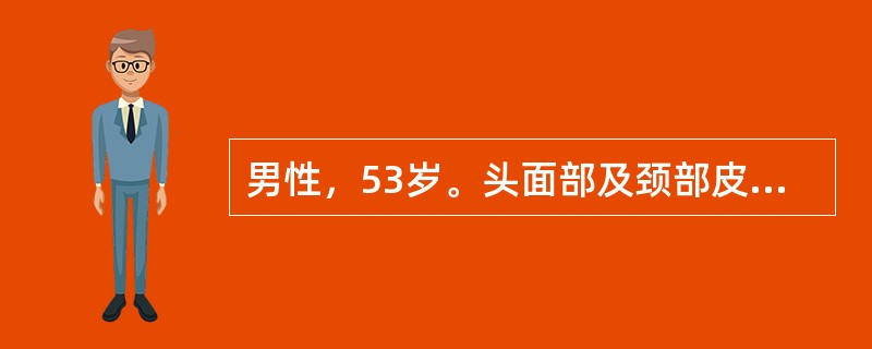 男性，53岁。头面部及颈部皮疹1年余，四肢乏力3个月。查体：眶周可见紫红色水肿斑，颈部红斑性皮疹，双侧肘关节、掌指关节、近端指间关节伸侧可见鳞屑性红色斑丘疹。四肢肌力Ⅲ级，肌肉压痛阳性。CK1000U