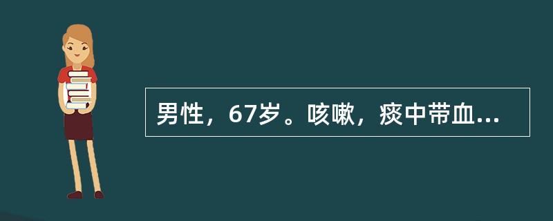 男性，67岁。咳嗽，痰中带血丝2个月，发热10天，胸片显示右肺上叶片状阴影，呈肺炎样征象。为明确诊断，应首选