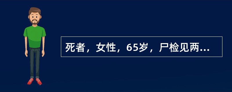 死者，女性，65岁，尸检见两肺缩小、变硬，肺组织呈蜂窝状改变，下叶脏层胸膜显著增厚，壁层胸膜出现纤维斑和广泛纤维化。该疾病的病变特点错误的是()