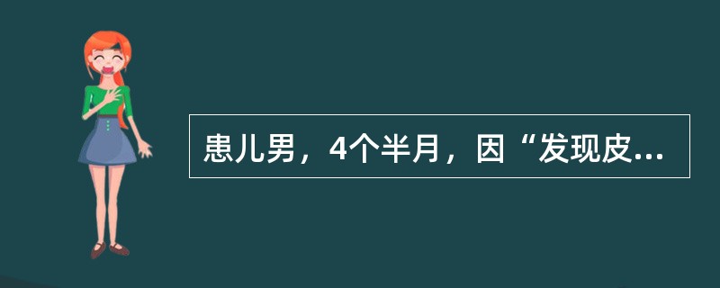 患儿男，4个半月，因“发现皮肤黄疸2周”来诊。查体：皮肤、巩膜中度黄染；肝肋下2cm，脾肋下1cm。肝功能：TBil82μmol/L，DBil38μmol/L，ALT95U/L，AST86U/L。如果