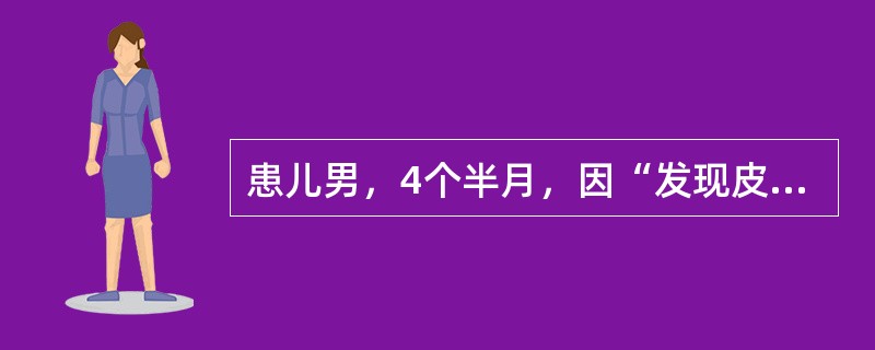 患儿男，4个半月，因“发现皮肤黄疸2周”来诊。查体：皮肤、巩膜中度黄染；肝肋下2cm，脾肋下1cm。肝功能：TBil82μmol/L，DBil38μmol/L，ALT95U/L，AST86U/L。不合