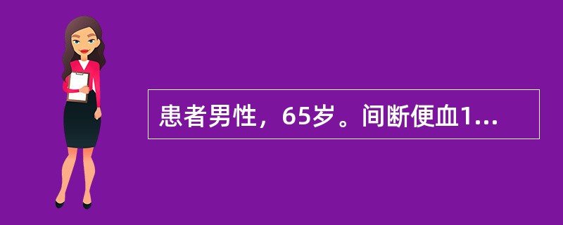 患者男性，65岁。间断便血1年，在多家医院检查，考虑为痔疮，应用药物治疗后，便血情况无明显缓解。近半年患者出现里急后重、便不尽感、排便困难。近两天患者出现腹胀，停止排气排便，来医院检查，经灌肠后结肠镜