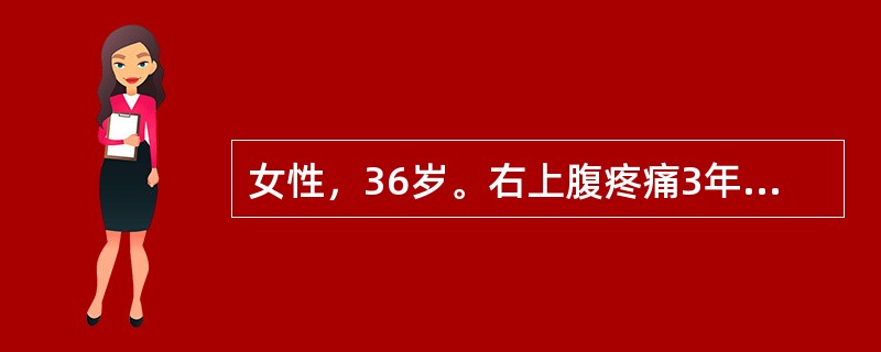 女性，36岁。右上腹疼痛3年，且反复发作。1天前进食油腻食物后腹痛，继之高热至39.2℃，疼痛向右肩背部放射，无黄疸。体查：右上腹压痛、反跳痛。该患者极有可能患的是