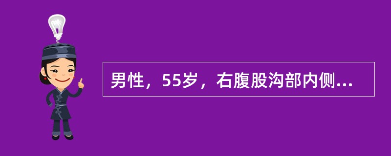 男性，55岁，右腹股沟部内侧有一球形肿块约两年余。肿块逐渐增大，影响劳动，站立时即刻出现，平卧时自行消退。查体：右腹股沟部内侧及耻骨结节外上方有一球形包块，未进入阴囊，可用手回纳，咳嗽时有膨胀性冲击感