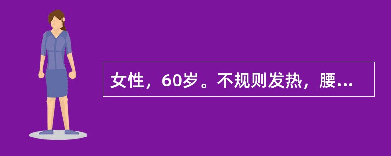 女性，60岁。不规则发热，腰痛，面部水肿5个月就诊。化验：尿蛋白(+++)，WBC5～10个／HP，尿本－周蛋白阳性，进一步做骨髓穿刺涂片见骨髓瘤细胞占0．20(20％)，此类细胞大，核仁明显，有双核