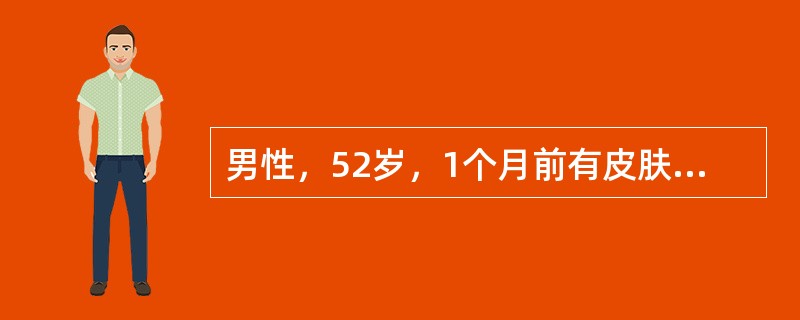 男性，52岁，1个月前有皮肤感染史，浮肿两周，尿少1周，血压165／100mmHg，化验尿蛋白(+++)，尿沉渣镜检BBC20～30／HP，血肌酐300μmol／L，尿素氮16．7mmol/L，血清C