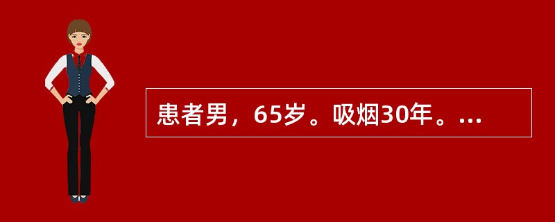 患者男，65岁。吸烟30年。1周来反复发作胸痛，与体力活动有关，休息可以缓解。6小时前出现持续性疼痛，进行性加剧，伴气促，不能平卧。查体：神志清楚，BP90/65mmHg，HR120次／分，律齐，心尖