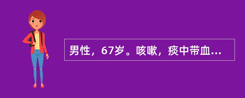 男性，67岁。咳嗽，痰中带血丝2个月，发热10天，胸片显示右肺上叶片状阴影，呈肺炎样征象。为明确诊断，应首选