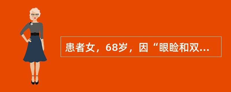 患者女，68岁，因“眼睑和双下肢水肿15d，夜间随地排尿、粪”来诊。患者有糖尿病病史10年，高血压病史1年。近1年降血糖药物方案：白天服用二甲双胍和格列奇特，睡前皮下注射人鱼精蛋白锌胰岛素N。同时服用