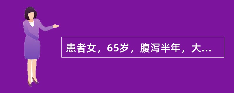 患者女，65岁，腹泻半年，大便3～5次/d，不成形，间断出现脓、血，伴左下腹痛，排便前发作，便后缓解，上述症状逐渐加重，伴消瘦。查体：腹软，左下腹可触及一包块，大小5cm×5cm，质硬，不活动。最可能
