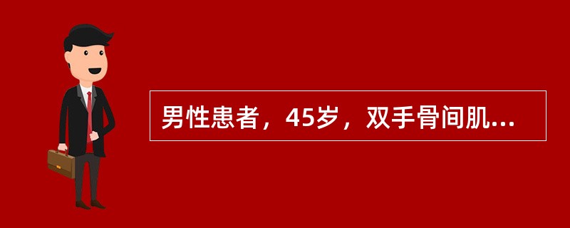 男性患者，45岁，双手骨间肌及大小鱼际肌肌肉萎缩1年，双手指活动不灵3个月，查体双手远端肌力4级，双手骨间肌及大小鱼际肌肌肉萎缩，以右侧为重，无感觉障碍，四肢腱反射活跃，双病理征阳性。若肌电图显示神经