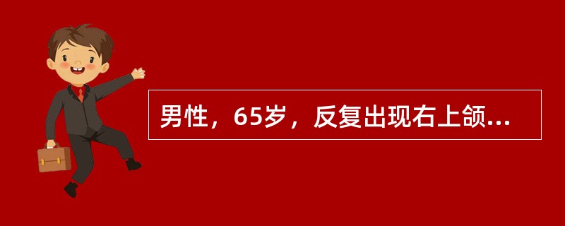 男性，65岁，反复出现右上颌部疼痛不适，呈闪电样、针刺样疼痛，每次发作持续数秒，进食时频繁，间歇期正常此病的表现不包括