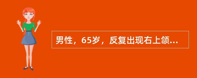 男性，65岁，反复出现右上颌部疼痛不适，呈闪电样、针刺样疼痛，每次发作持续数秒，进食时频繁，间歇期正常此患者最可能的诊断