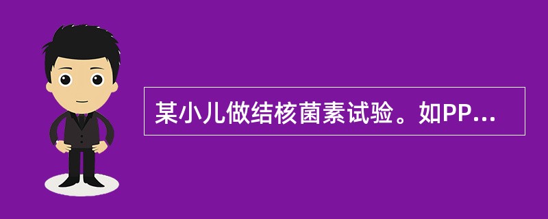 某小儿做结核菌素试验。如PPD红肿硬结面积为23mm，你应判断为