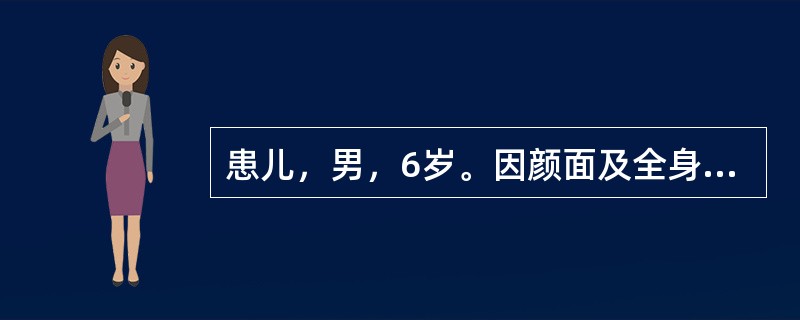 患儿，男，6岁。因颜面及全身水肿就诊，门诊以“肾病综合征”收入院。查体：面部、腹壁及双下肢明显水肿，呈凹陷性，腹部膨隆，腹水征(+)，阴囊明显水肿，囊壁变薄透亮呈球形。实验室检查：尿蛋白(++++)，