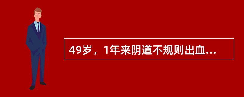 49岁，1年来阴道不规则出血，分泌物臭，宫颈呈菜花样，右侧宫旁组织增厚，但未达盆壁，阴道上1/3质硬、不平。临床分期正确的是