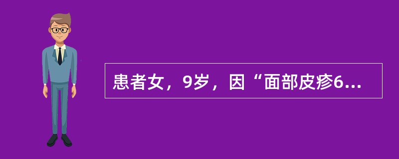 患者女，9岁，因“面部皮疹6个月，水肿2周”来诊。查体：BP140/90mmHg。实验室检查：Hb75g/L；尿蛋白（+++），尿沉渣RBC10~15/HP；ANA（＋），抗dsDNA（＋）。临床诊断