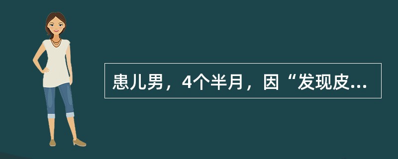 患儿男，4个半月，因“发现皮肤黄疸2周”来诊。查体：皮肤、巩膜中度黄染；肝肋下2cm，脾肋下1cm。肝功能：TBil82μmol/L，DBil38μmol/L，ALT95U/L，AST86U/L。不合