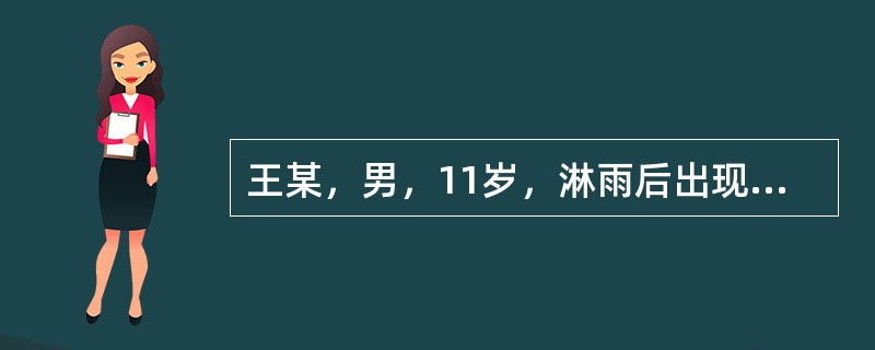 王某，男，11岁，淋雨后出现头痛，恶寒发热，项背强直，肢体酸重，苔白腻，脉浮紧。如为刚痉，方剂宜选：