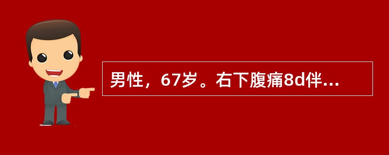 男性，67岁。右下腹痛8d伴呕吐，体温35℃，脉搏120次/分，血压10.7/6.67kPa(80/50mmHg)，神志不清，烦躁不安，全腹压痛、反跳痛.四肢冰冷、青紫呈花斑发绀，尿量<25ml