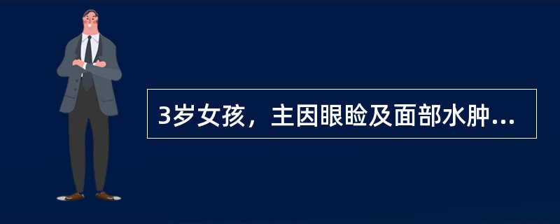 3岁女孩，主因眼睑及面部水肿两周就诊。查体：血压90／68mmHg，全身高度水肿呈凹陷性。实验室检查尿蛋白++++，尿红细胞1～2／HP。肾病综合征，首选应用的细胞毒药物是