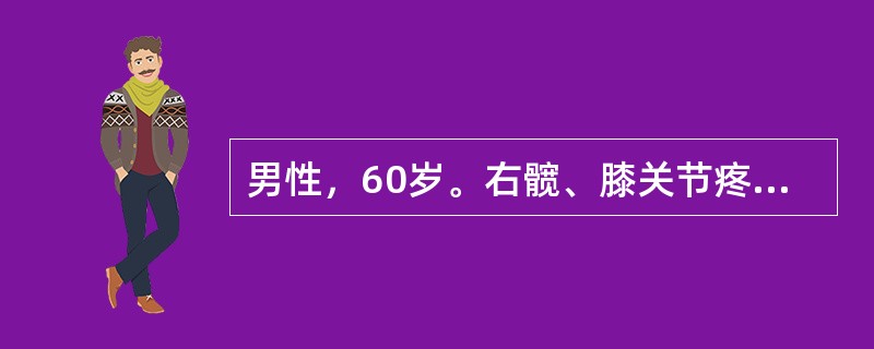 男性，60岁。右髋、膝关节疼痛2年，加重3个月。现感疼痛明显加重，休息后亦无明显缓解。晨起髋关节有僵硬感，一般活动15分钟后僵硬感消失。体格检查：右膝关节无异常体征。右髋关节屈曲位，右“4”字试验阳性