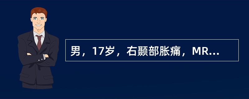 男，17岁，右颞部胀痛，MRI如图所示，最可能的诊断是<img border="0" style="width: 176px; height: 195px;&quo