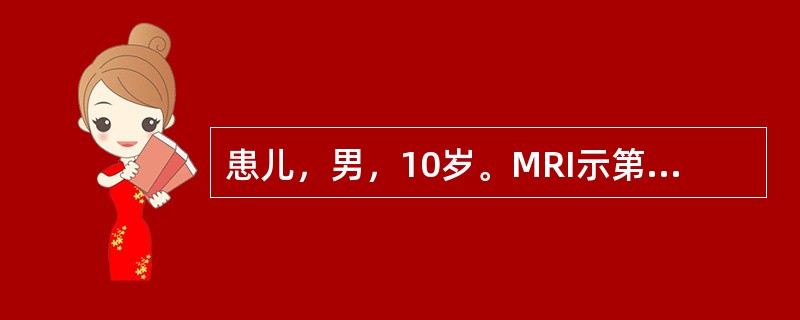 患儿，男，10岁。MRI示第四脑室内一边界清楚的分叶状肿物，呈T<img border="0" style="width: 10px; height: 16px;&