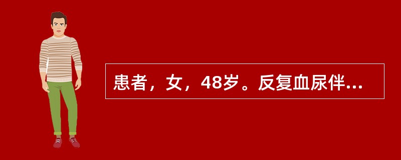 患者，女，48岁。反复血尿伴右侧腰痛7个月。CT扫描图像见图。最有可能的诊断是<img border="0" style="width: 282px; height