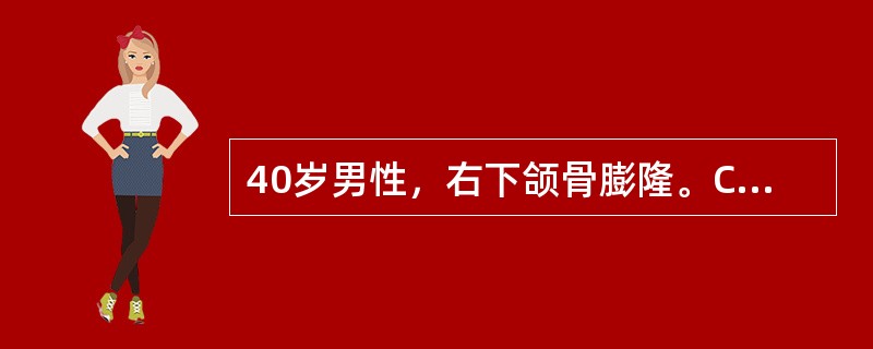 40岁男性，右下颌骨膨隆。CT示右下颌角有一2.5cm×3.0cm囊实性肿块，分叶多房状，最可能的诊断是