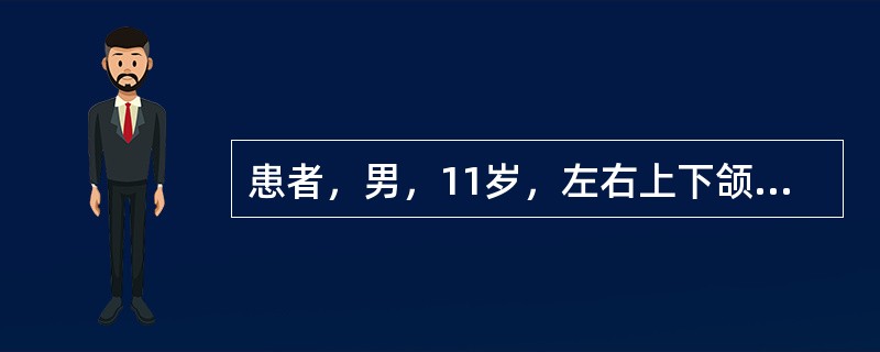 患者，男，11岁，左右上下颌第一磨牙反袷，左右上尖牙缺失，上颌后缩，下颌前突，前牙反，面中1／3凹陷，下颌可后退至对刃。X线见左右上尖牙龈下3mm阻生，侧切牙与第一前磨牙之间各3mm间隙。对埋伏的左右