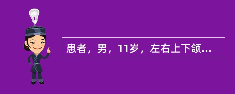 患者，男，11岁，左右上下颌第一磨牙反袷，左右上尖牙缺失，上颌后缩，下颌前突，前牙反，面中1／3凹陷，下颌可后退至对刃。X线见左右上尖牙龈下3mm阻生，侧切牙与第一前磨牙之间各3mm间隙。病例应诊断为