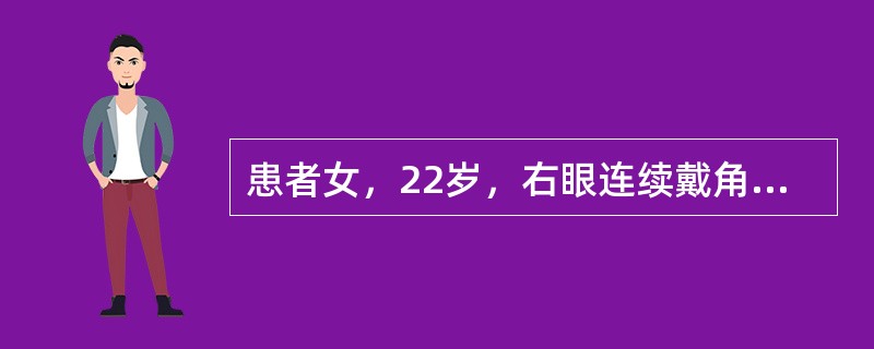 患者女，22岁，右眼连续戴角膜接触镜2周，出现眼红、眼痛、视力下降11天。眼部检查：右眼视力F.C./30mm，眼睑红肿(+++)，睑痉挛(+++)，混合充血(+++)，角膜中央部见7mm×7mm环形