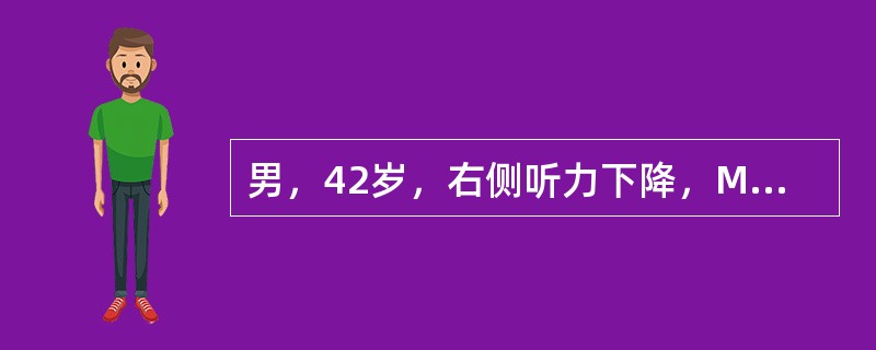 男，42岁，右侧听力下降，MRI检查如图，最可能的诊断为 ( )<img style="width: 261px; height: 196px;" src="htt