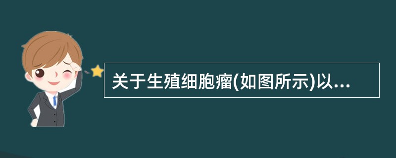 关于生殖细胞瘤(如图所示)以下描述中不正确的是 ( )<img style="width: 205px; height: 228px;" src="https://