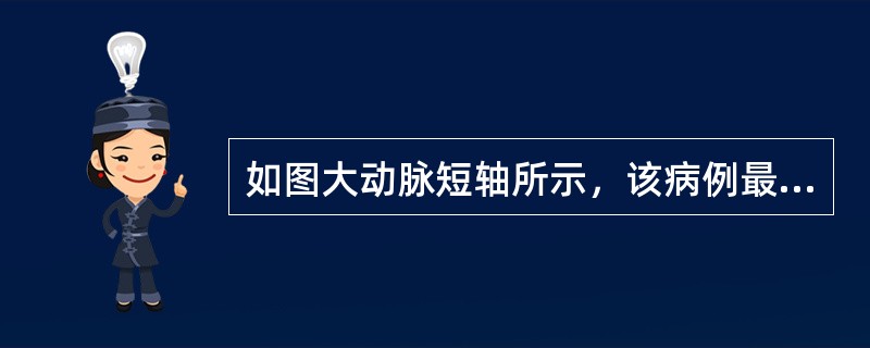 如图大动脉短轴所示，该病例最有可能的诊断为<img border="0" style="width: 357px; height: 268px;" src