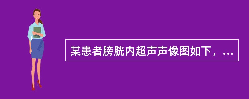 某患者膀胱内超声声像图如下，最可能的诊断为()<img border="0" style="width: 461px; height: 346px;" s