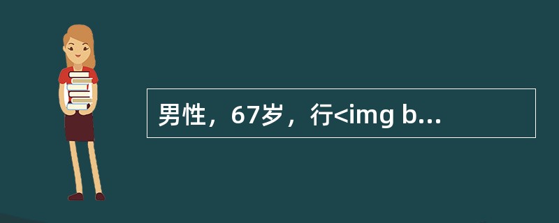 男性，67岁，行<img border="0" style="width: 16px; height: 18px;" src="https://