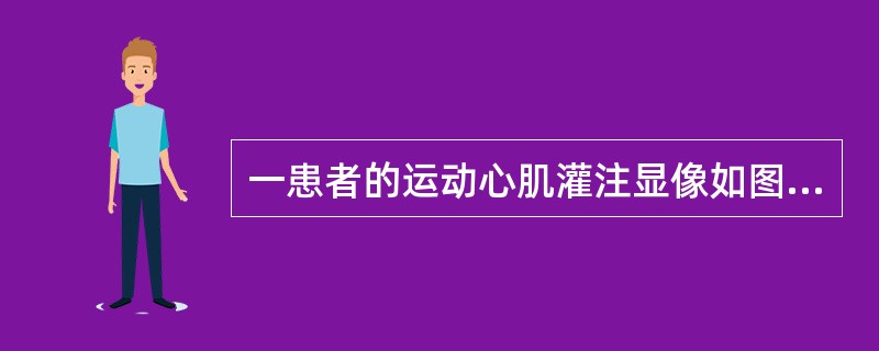 一患者的运动心肌灌注显像如图，正确的诊断是()<img border="0" style="width: 578px; height: 433px;" s