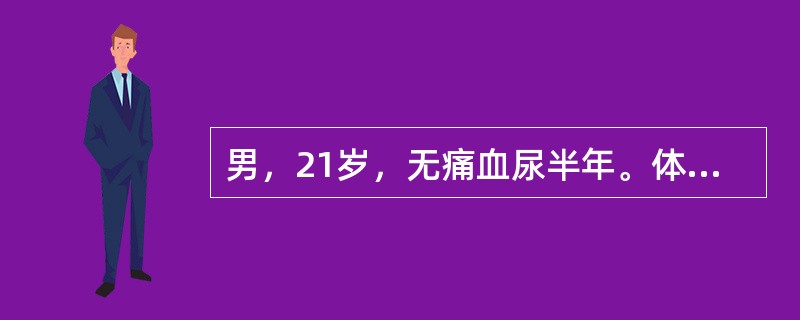 男，21岁，无痛血尿半年。体检恶病质面容。行全身骨显像如图。对此描述正确的是()<img border="0" style="width: 514px; heigh