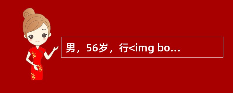 男，56岁，行<img border="0" style="width: 16px; height: 18px;" src="https://i
