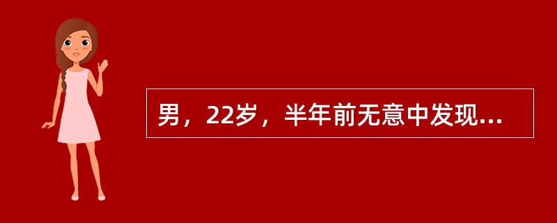 男，22岁，半年前无意中发现左颌下肿物。CT表现如图所示，最可能诊断为<img border="0" style="width: 349px; height: 17