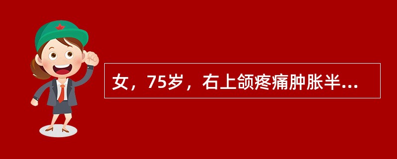 女，75岁，右上颌疼痛肿胀半年余，CT检查如图，最可能的诊断是()<img border="0" style="width: 235px; height: 176p