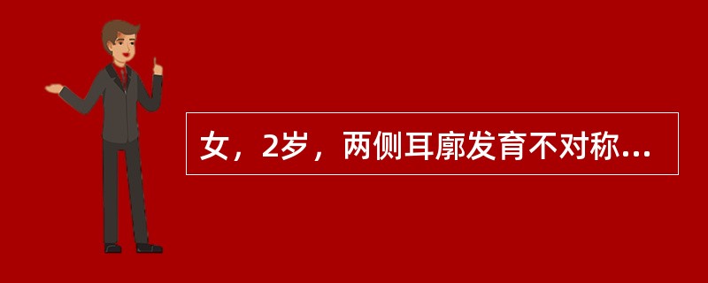 女，2岁，两侧耳廓发育不对称，左侧听力差，如图所示，最可能的诊断为()<img border="0" style="width: 304px; height: 22