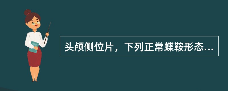 头颅侧位片，下列正常蝶鞍形态中，哪项不正确()