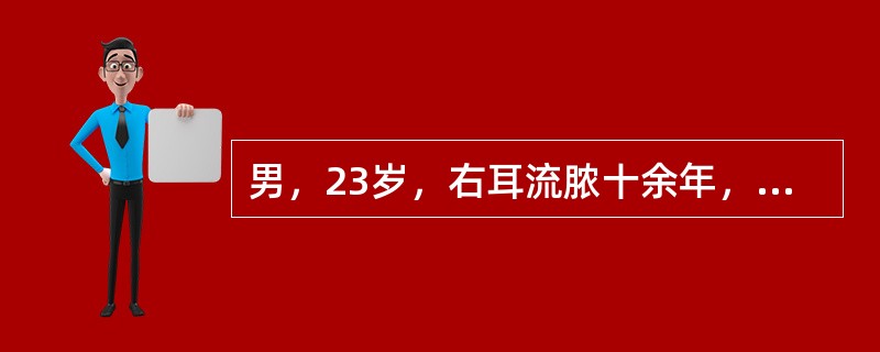 男，23岁，右耳流脓十余年，右外耳道流脓，鼓膜穿孔，CT检查如图，最可能诊断为()<img border="0" style="width: 270px; heig