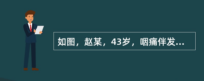 如图，赵某，43岁，咽痛伴发热、头痛2天就诊，T38.3℃，检查见口咽粘膜急性充血腭弓、腭垂水肿、咽后壁淋巴滤泡红肿，颌下淋巴结肿大、轻压痛，根据其临床表现初步考虑为()<img border=