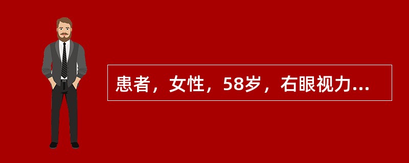 患者，女性，58岁，右眼视力下降3个月，伴眼痛3天。VodHM／10cm，Tod38mmHg，Vos1．0，Tos12mmHg，右眼混合充血，角膜透明，前房轴深3.5C．T．，房水（-），虹膜面见新生